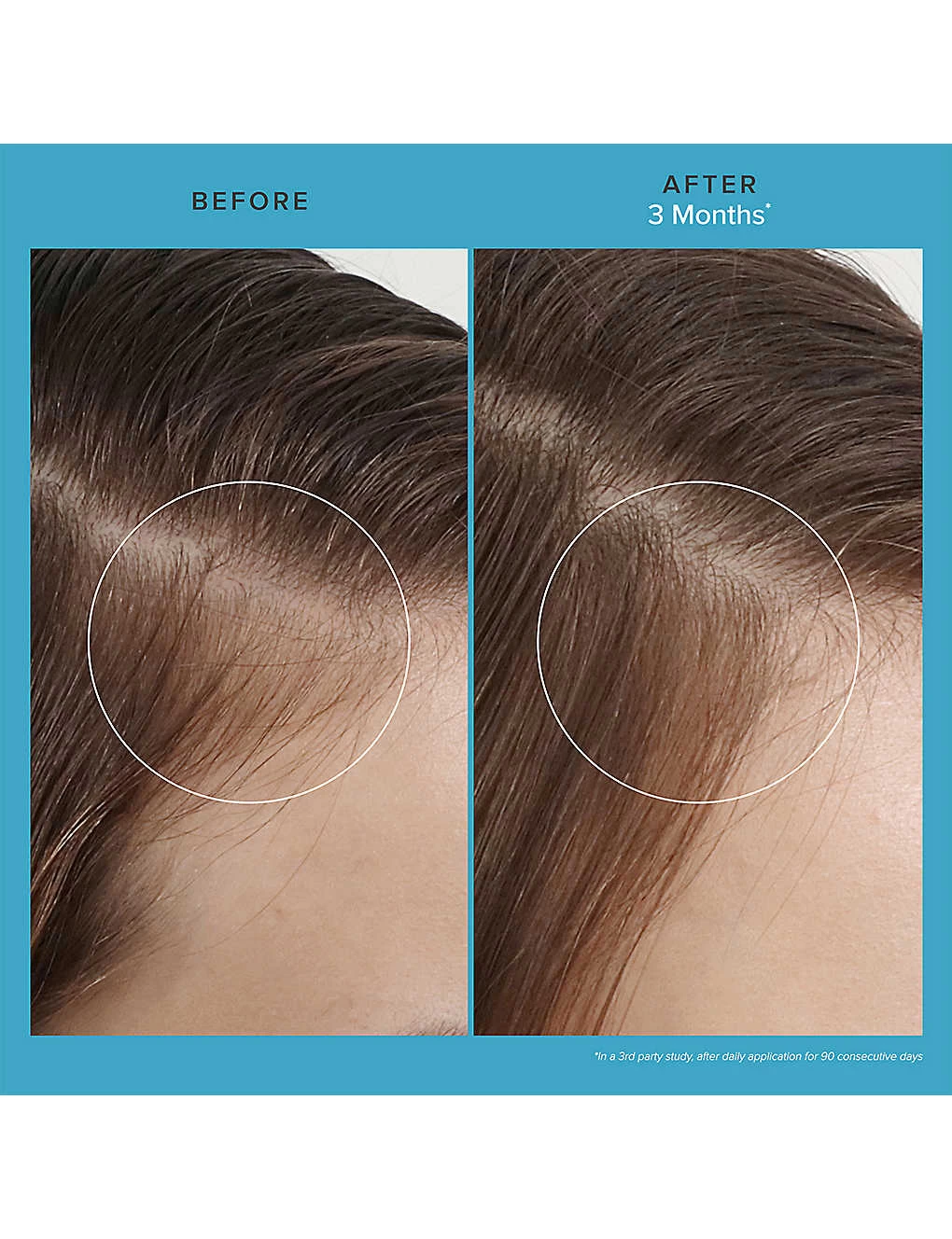 Living Proof Scalp Care Revitalizing Treatment 73ml - Image 3