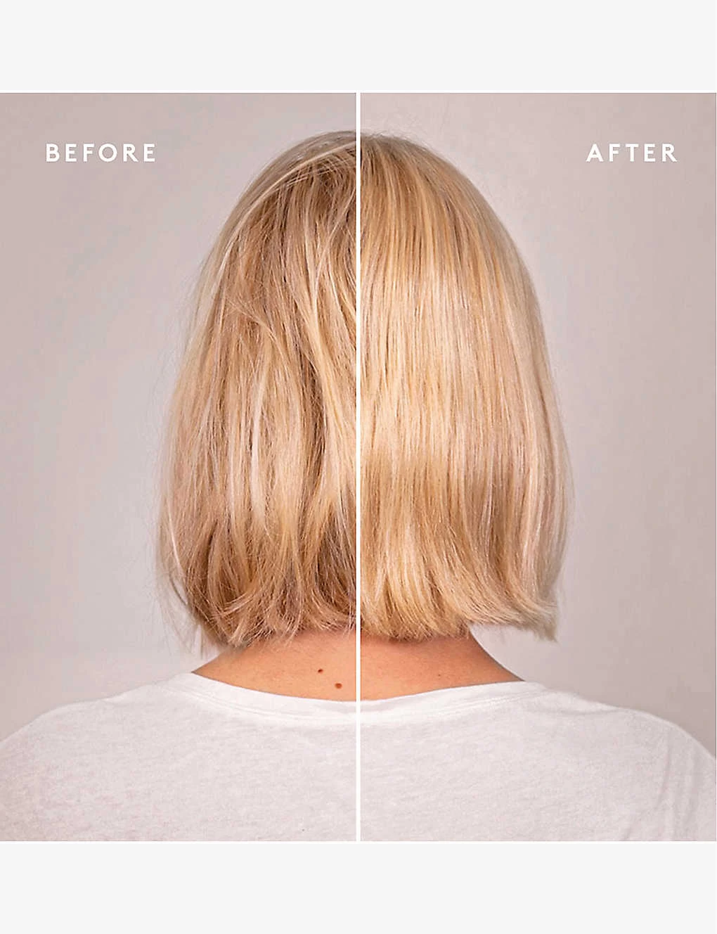 VIRTUE Recovery Discovery Kit - Image 5