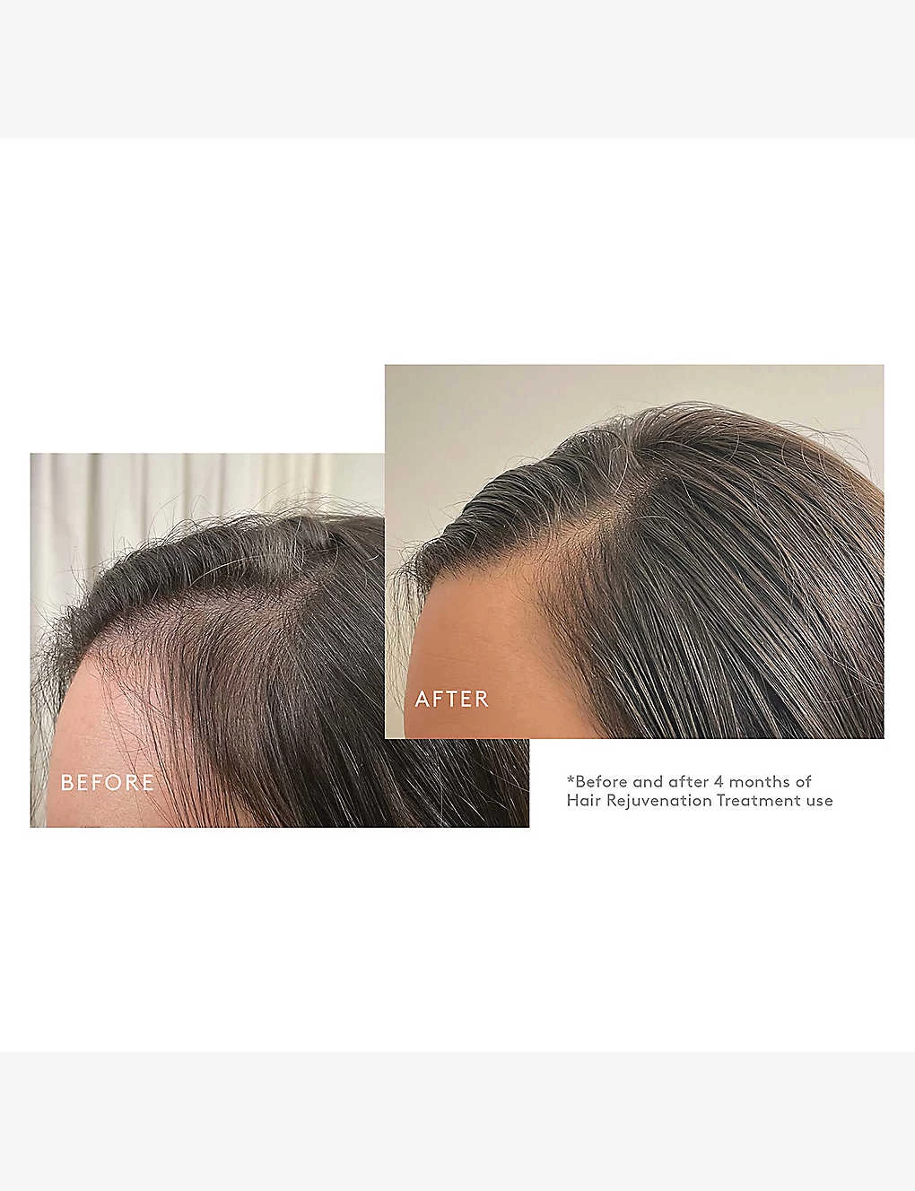 VIRTUE Flourish Hair Rejuvenation Treatment Set - Image 8