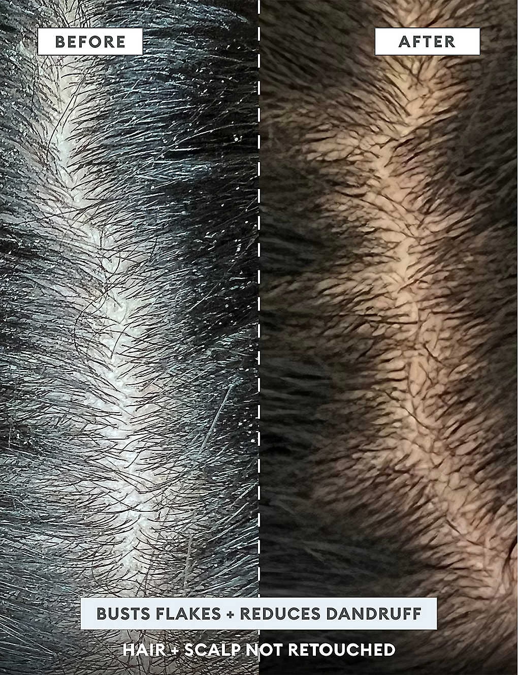 MegaStrength Dandruff Control Shampoo 240ml - Image 10