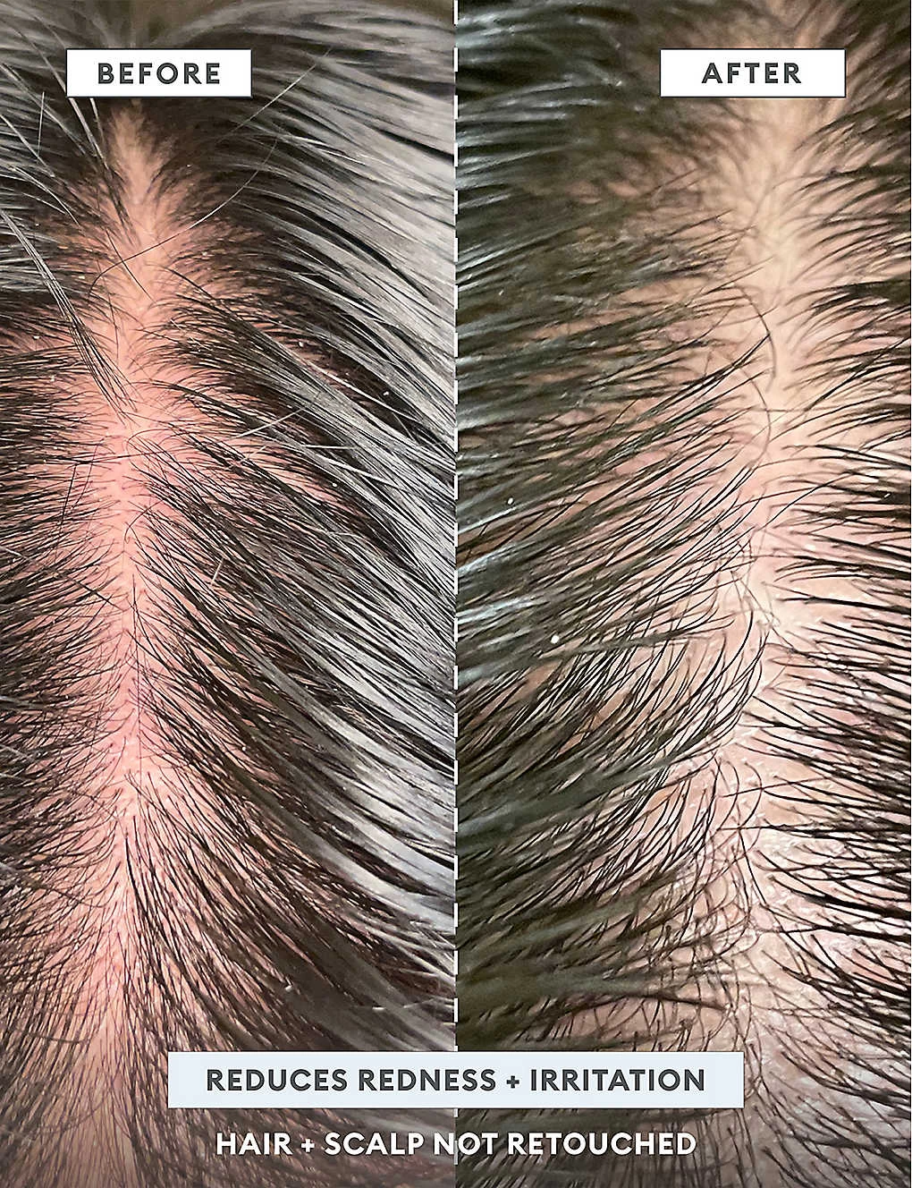 MegaStrength Dandruff Control Shampoo 240ml - Image 11