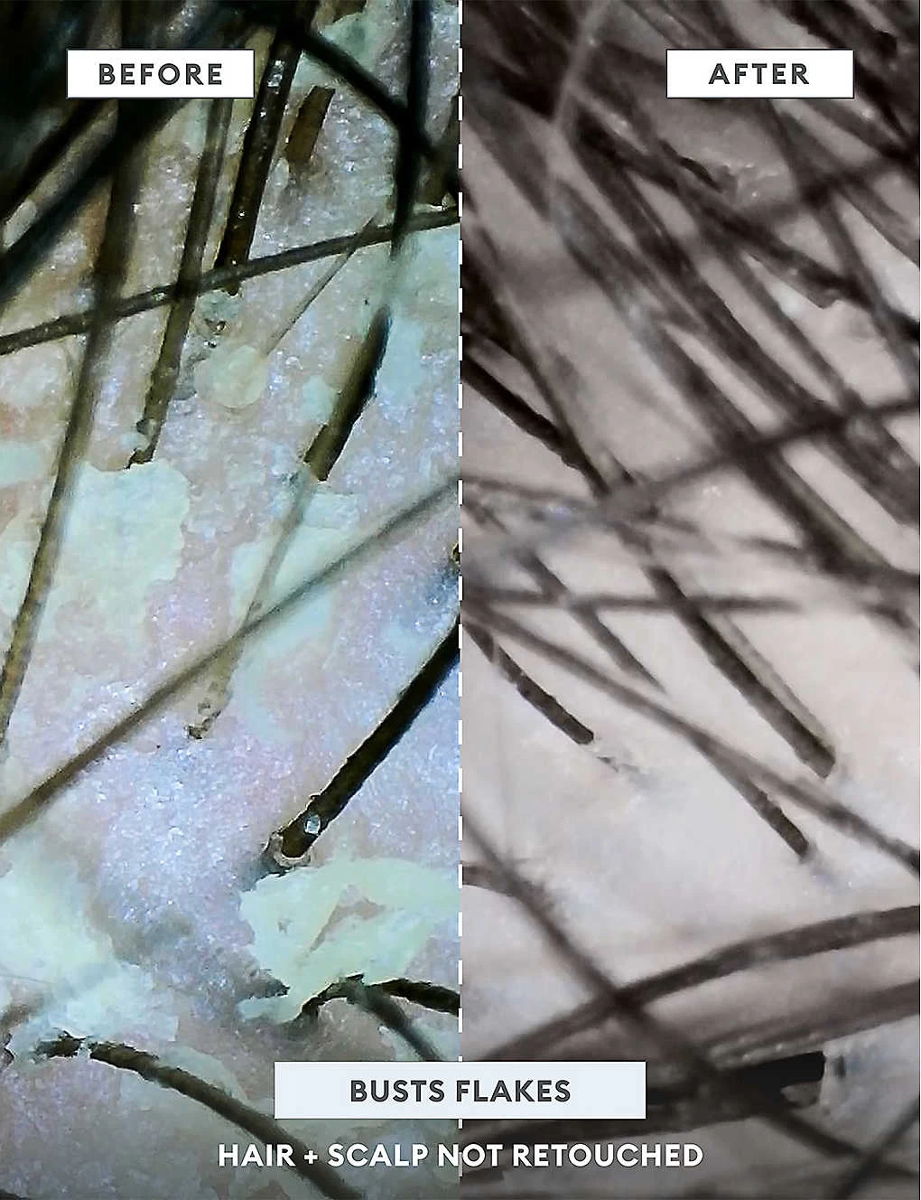 MegaStrength Dandruff Control Shampoo 240ml - Image 12