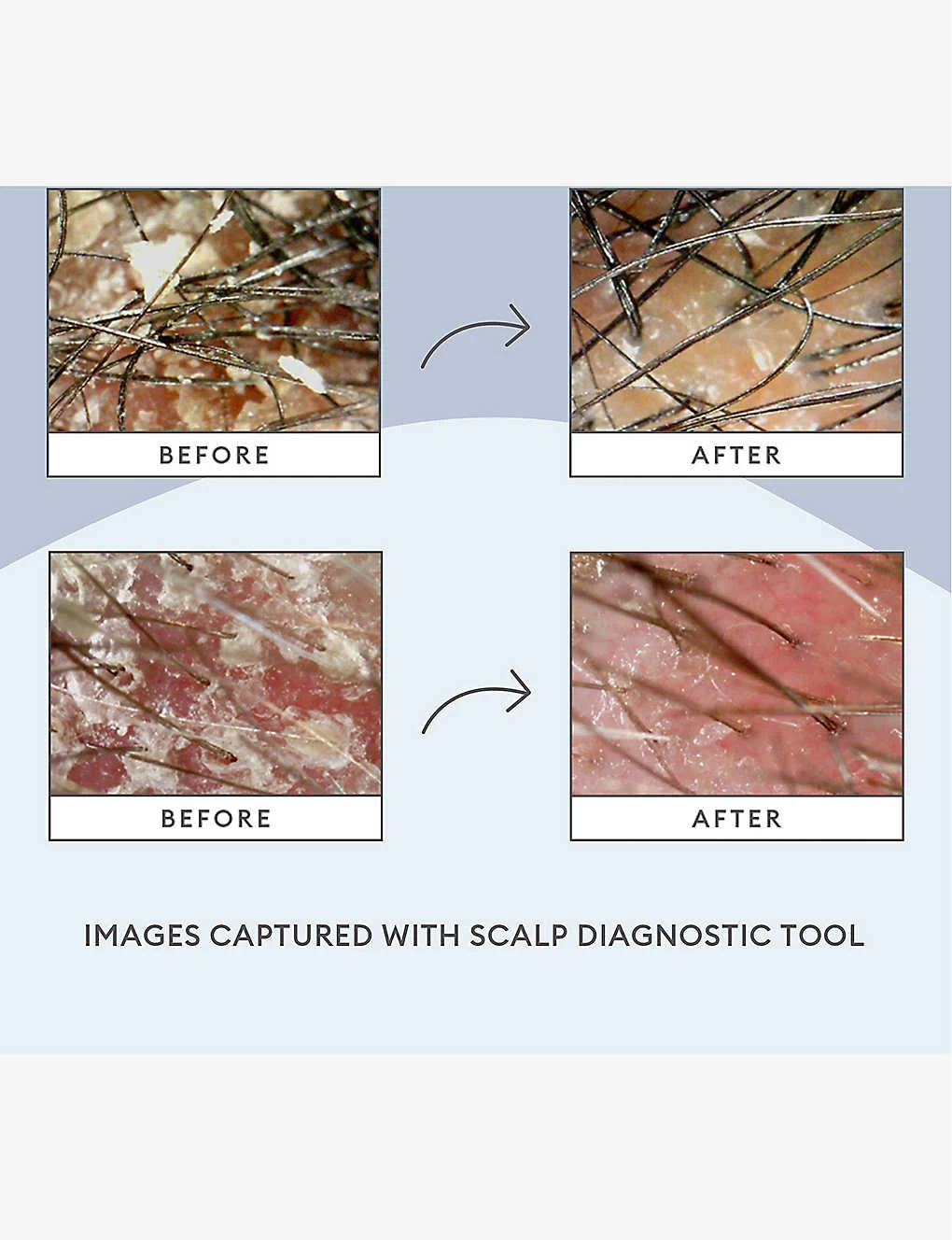 Scalp Revival Scalp Mask 177ml - Image 8