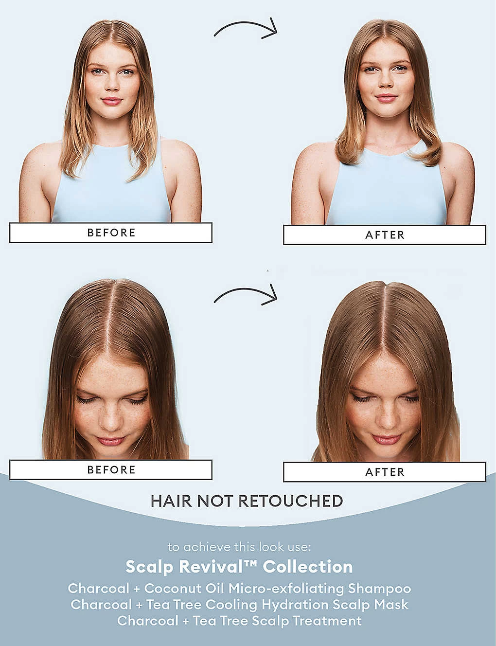 Scalp Revival Scalp Mask 177ml - Image 9