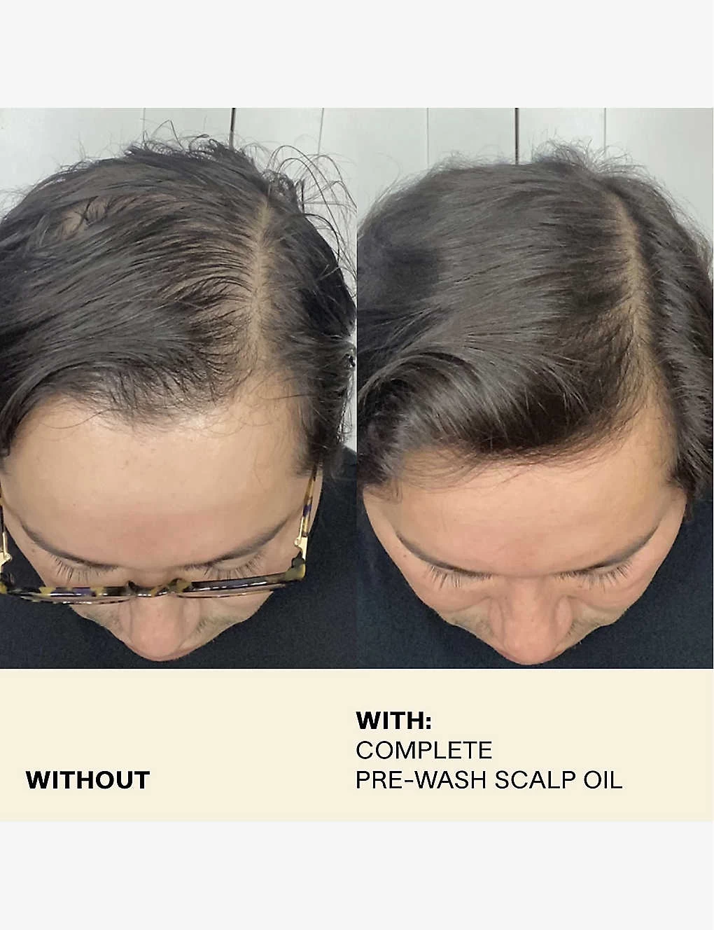 Complete Pre-wash Scalp Oil 50ml - Image 6